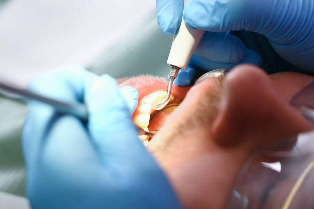 Best Emergency Gum Treatment in Point Mackenzie, AK